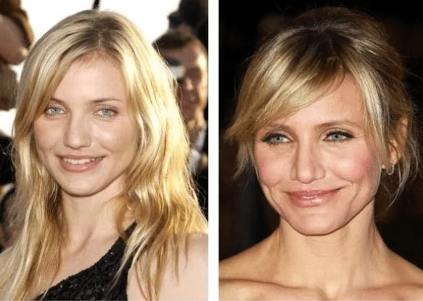 cameron diaz teeth transformation
