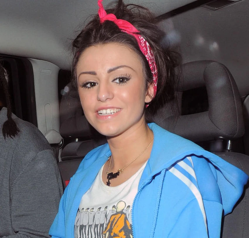 cher lloyd teeth in 2005