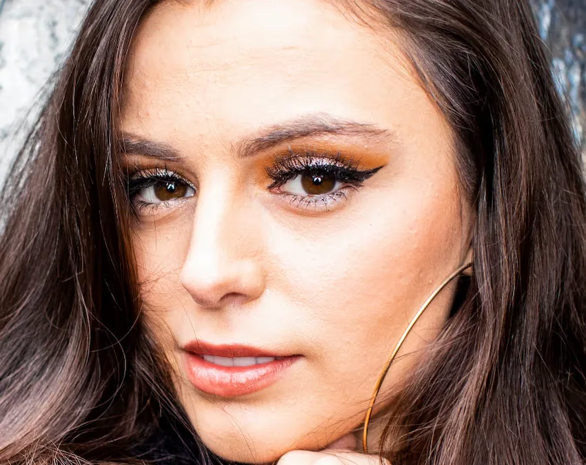 cher lloyd teeth in 2020