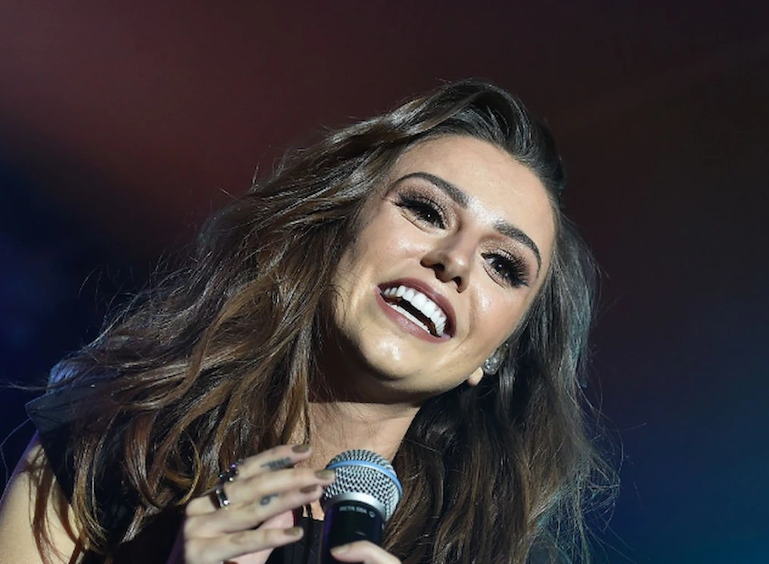 cher lloyd teeth in 2025
