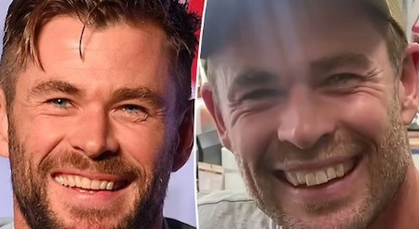chris hemsworth teeth