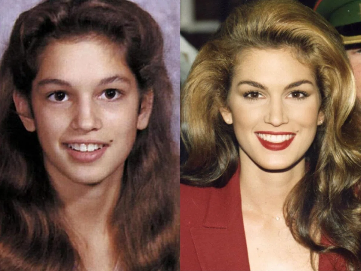 cindy crawford teeth before after