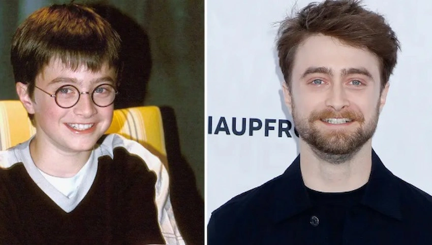 daniel radcliffe teeth
