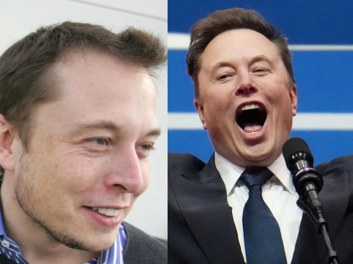 elon musk teeth before after