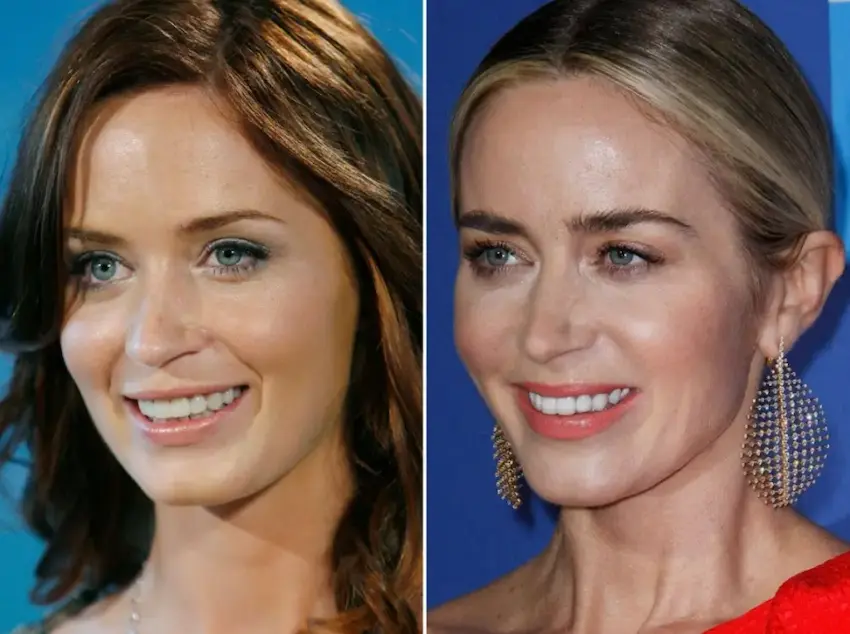 emily blunt teeth transformation new