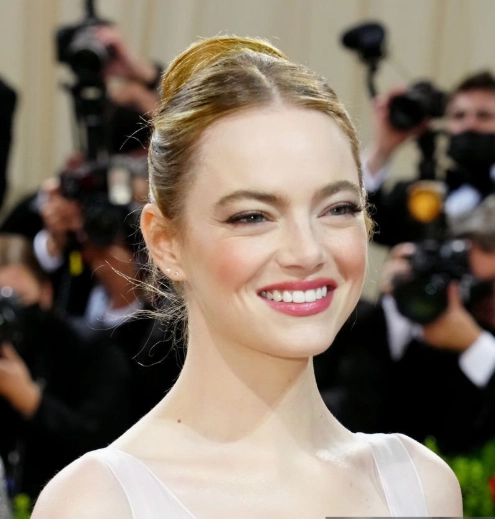emma stone teeth in 2022