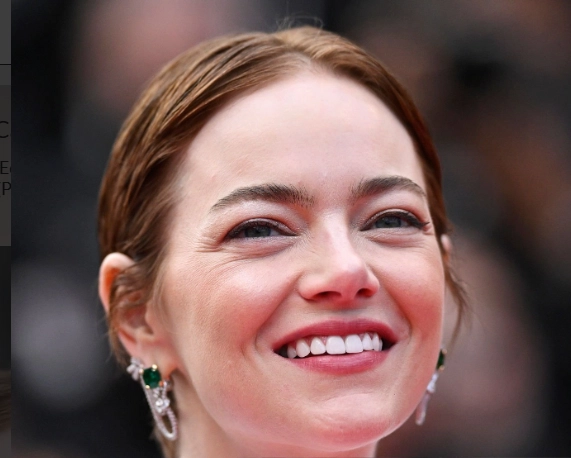 emma stone teeth in 2025
