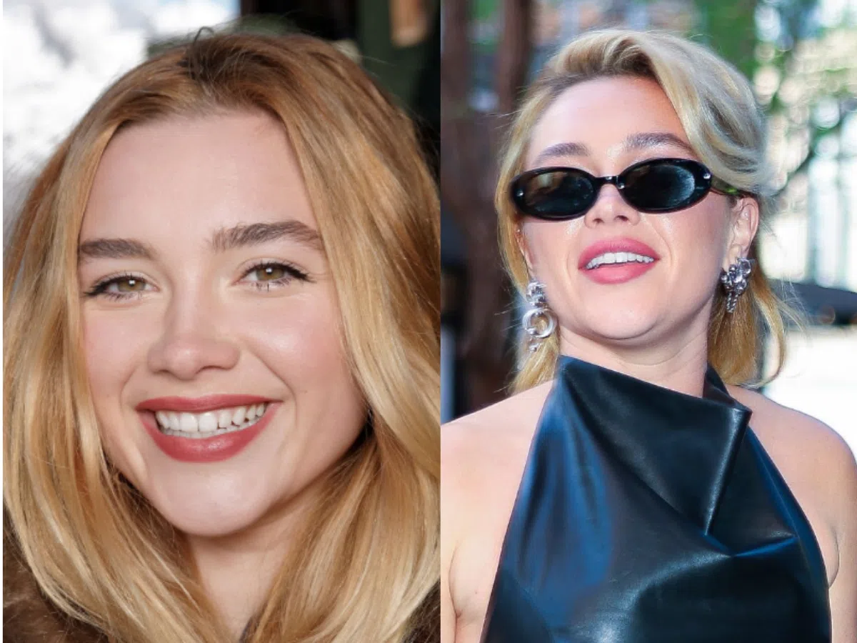 florence pugh teeth before after