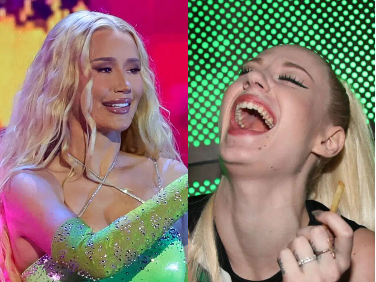 iggy azalea teeth before after