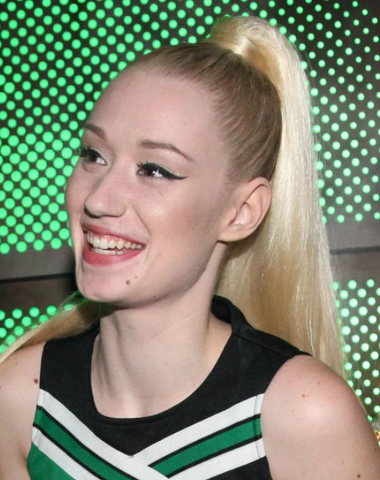 iggy azalea teeth in 2012