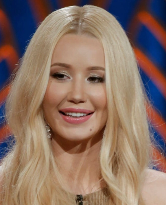 iggy azalea teeth in 2017