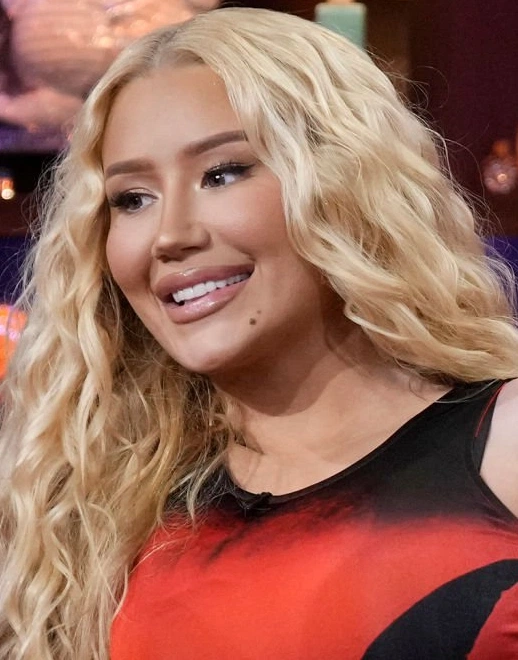 iggy azalea teeth in 2023