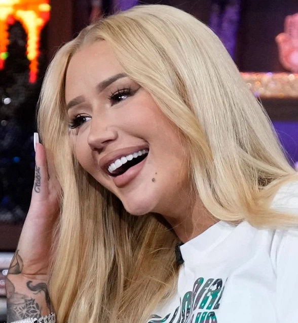 iggy azalea teeth in 2025