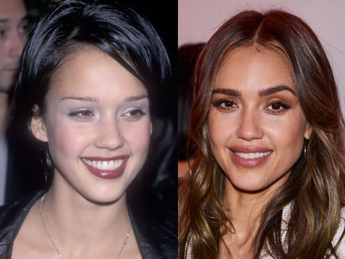 jessica alba teeth before after