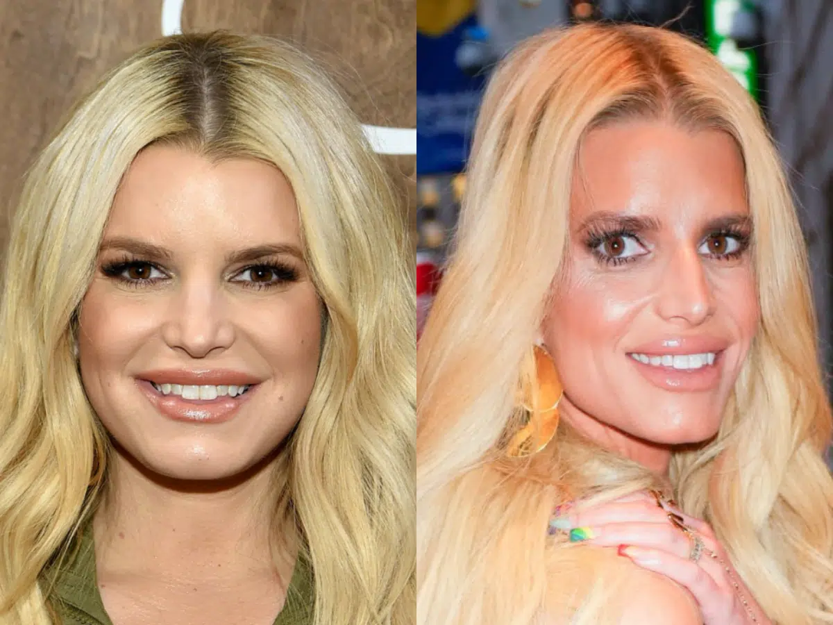 jessica simpson teeth before after