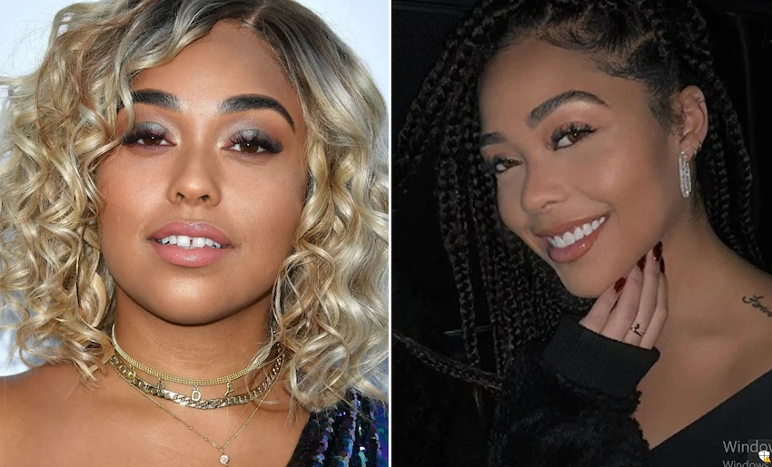 jordyn woods teeth before after