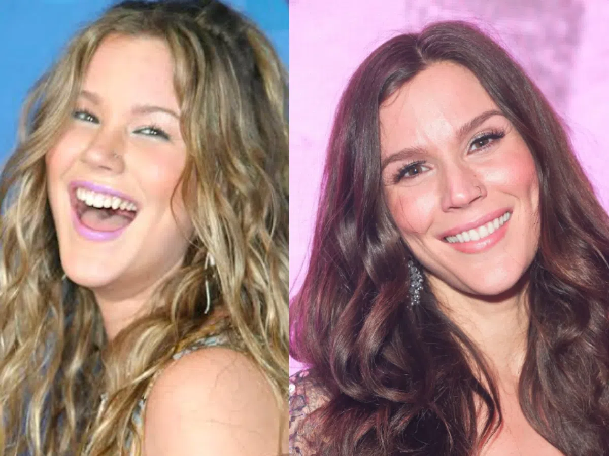 joss stone teeth before after