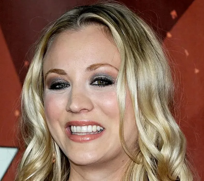 kaley cuoco teeth