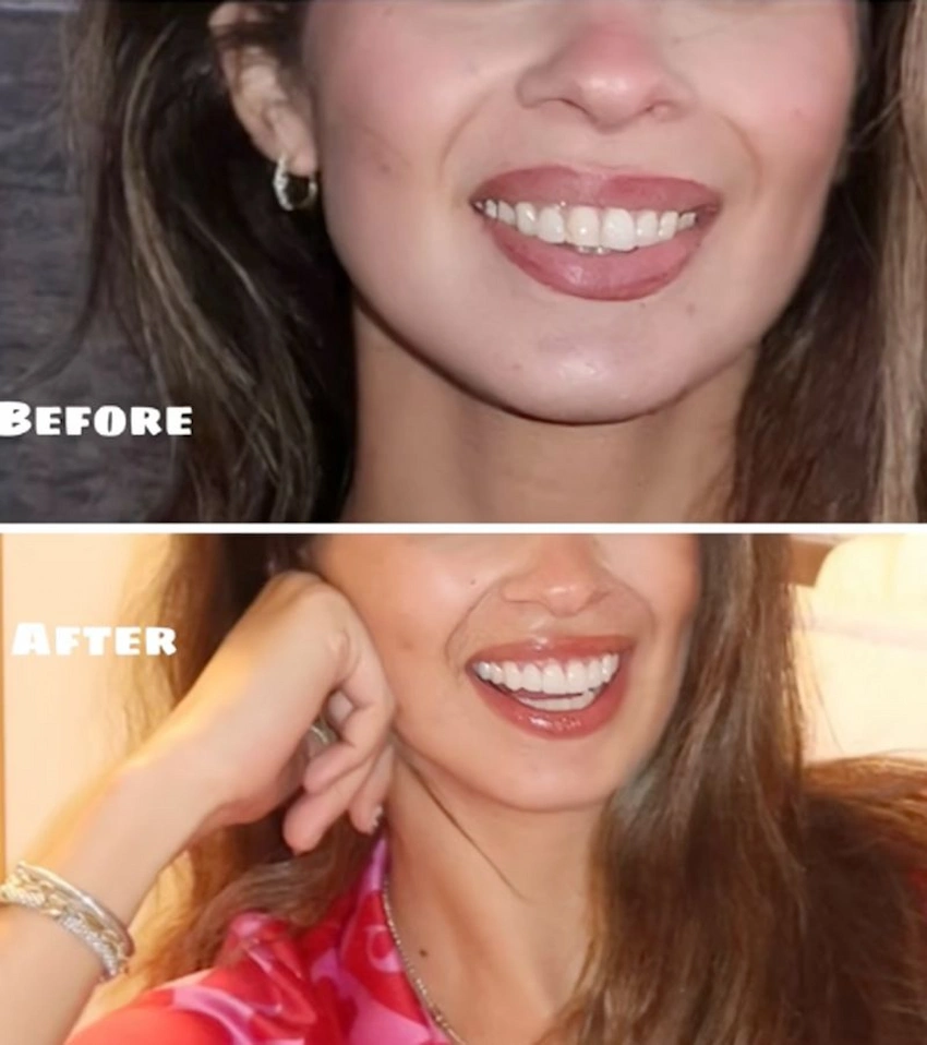 kelsey anderson teeth 2010