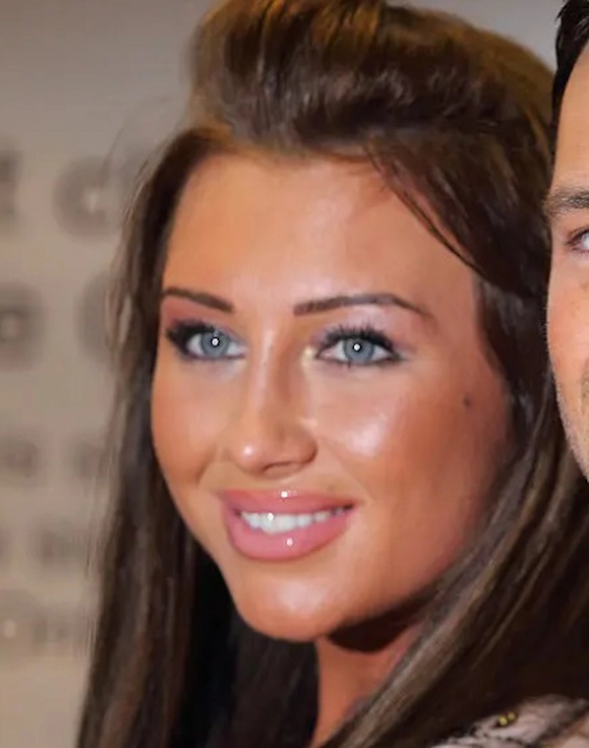 lauren goodger teeth