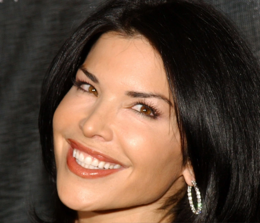 lauren sanchez teeth 2005