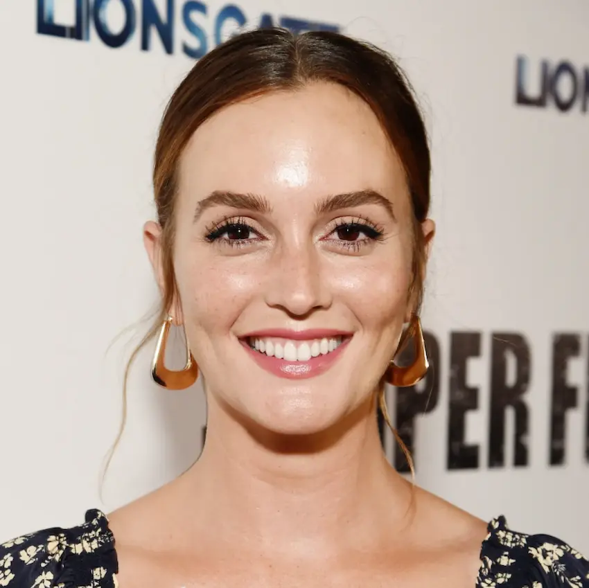 leighton meester teeth 2025s