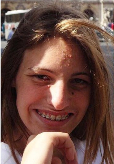 lele pons dişleri 2010