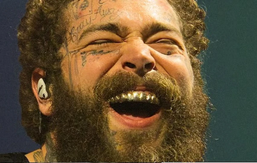 post malone dental