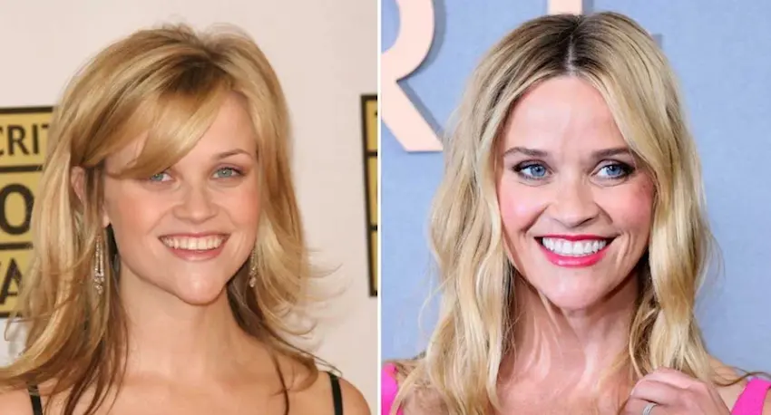 reesee witherspoon teeth transformation