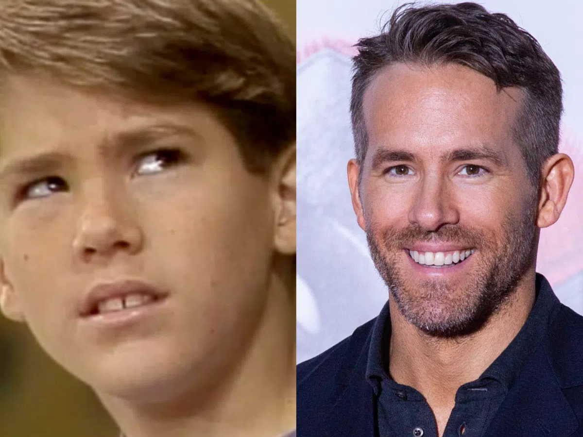 ryan reynolds teeth before after