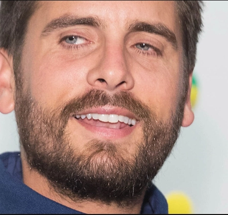 scott disick teeth in 2015