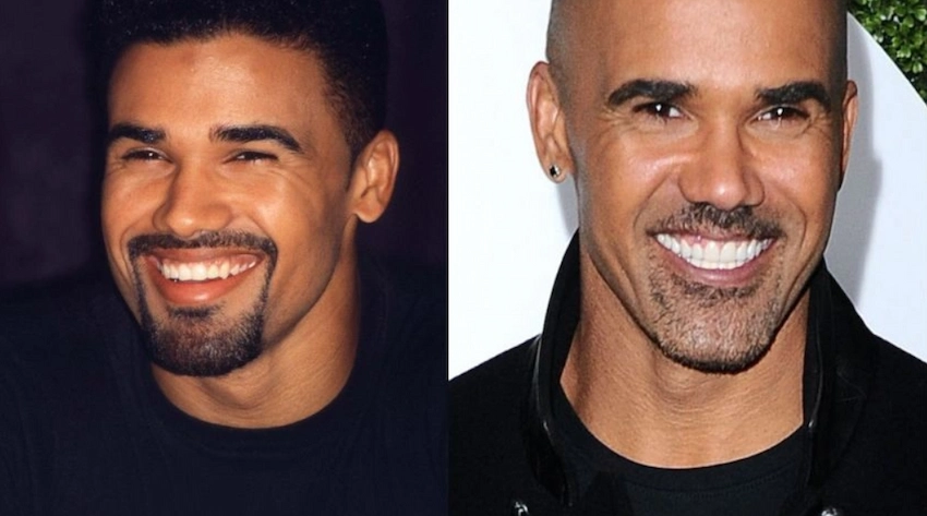 shemar moore teeth before after