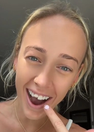 sophie cunningham broke teeth