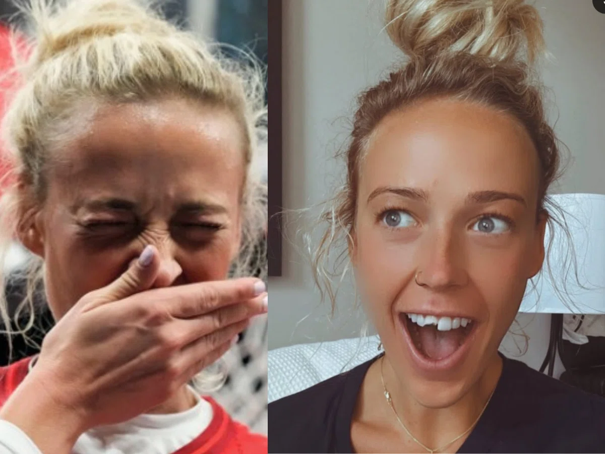 sophie cunningham teeth broken