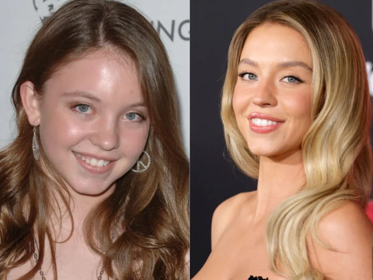 sydney sweeney teeth before after