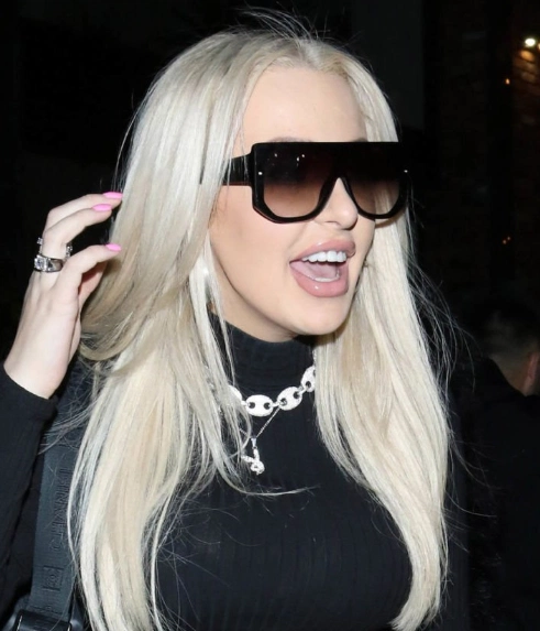 tana mongeau teeth in 2020