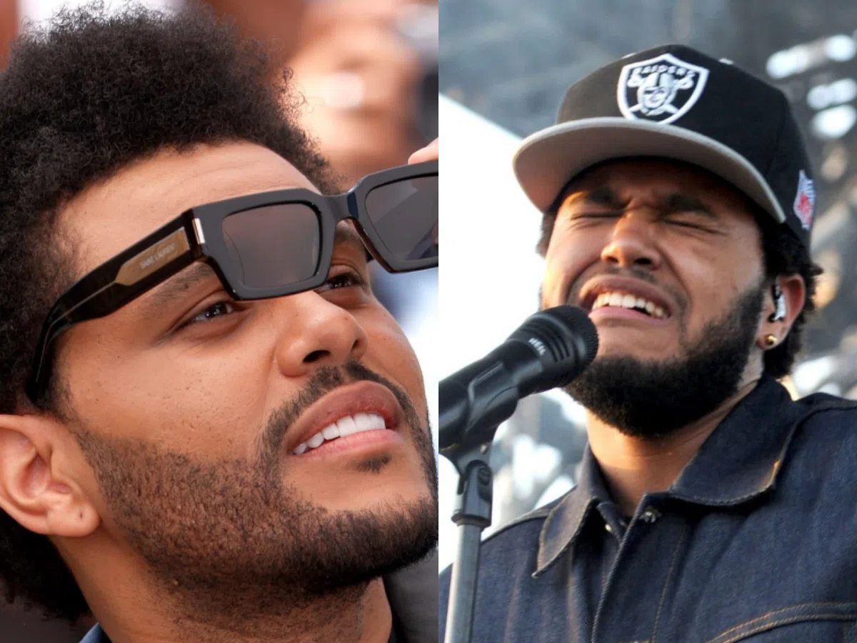the weeknd teeth before after