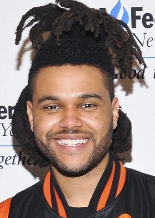the weeknd teeth in 2014