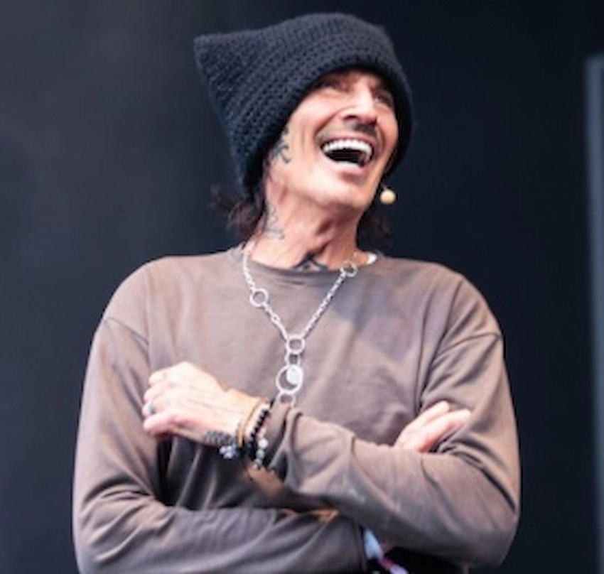 tommy lee teeth 2025