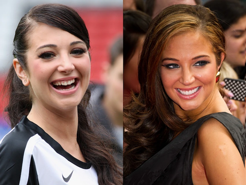 tulisa contostavlos teeth before after