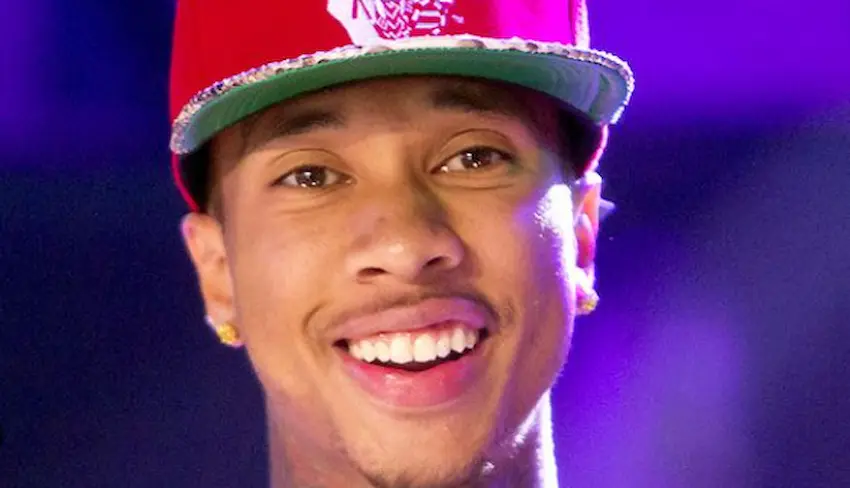 tyga teeth 2010s