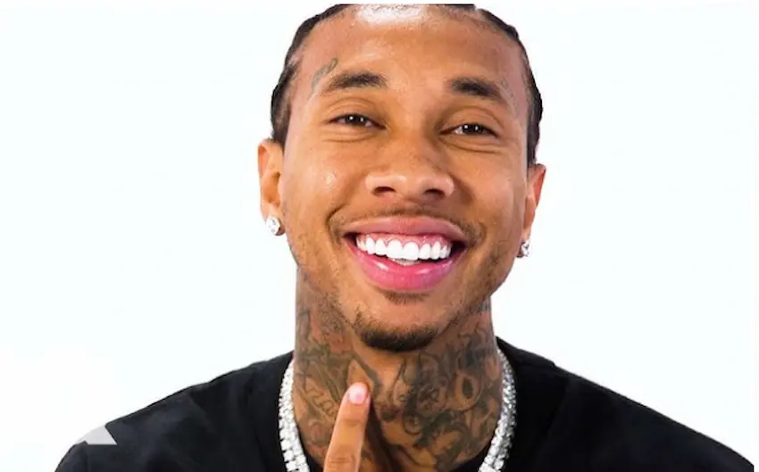 tyga teeth 2025s