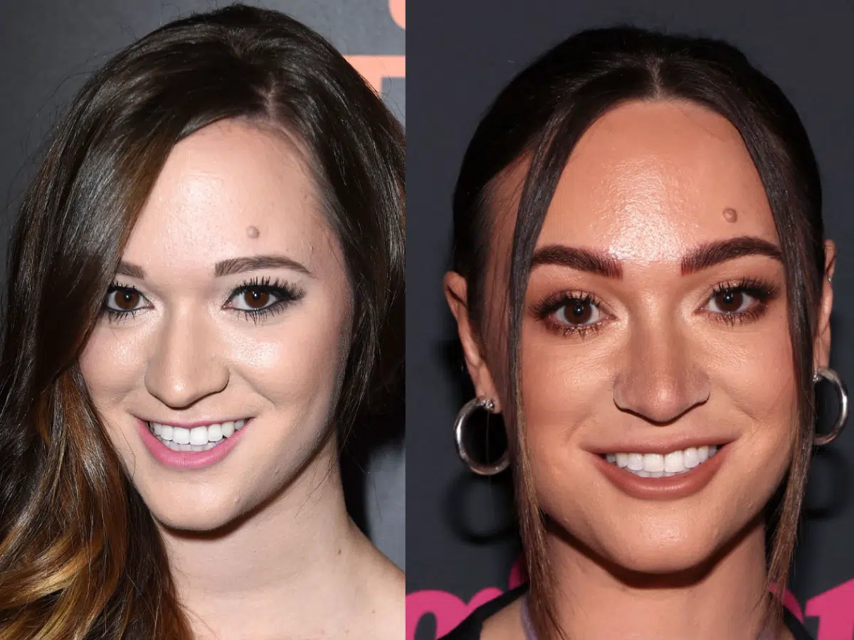 alisha marie teeth before after