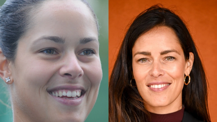 ana ivanovic teeth before after