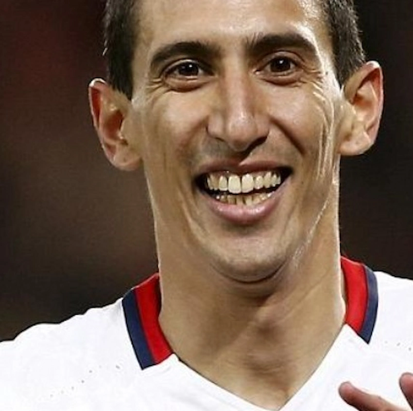 angel di maria teeth