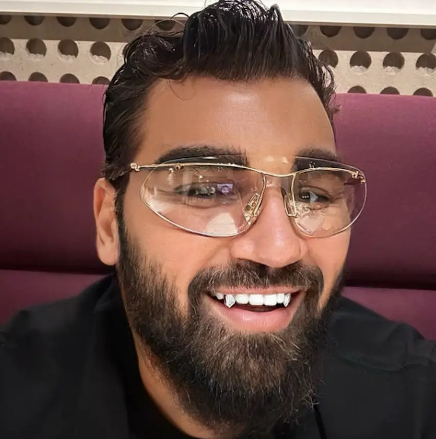 azis teeth 2010s