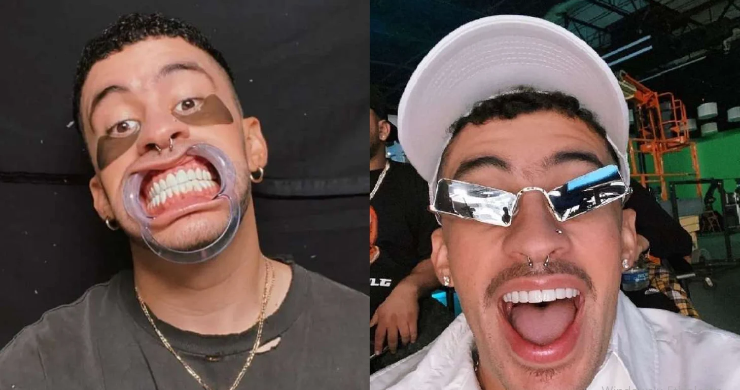 bad bunny teeth cover