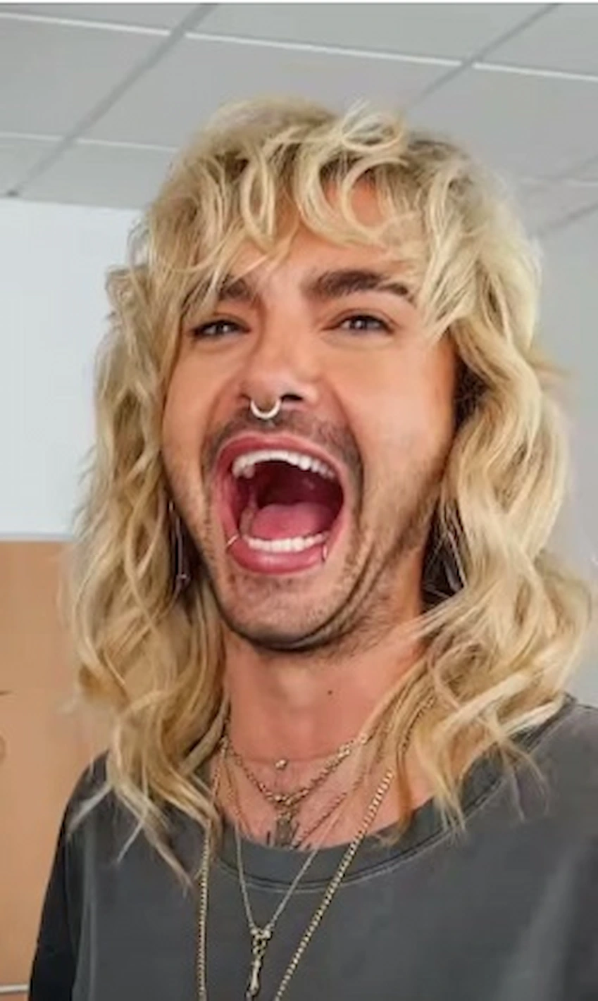 bill kaulitz teeth