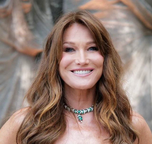dents carla bruni sarkozy en 2025