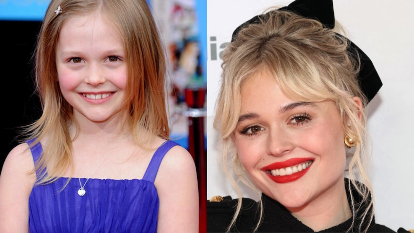 emily alyn lind teeth before after